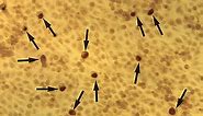 Chlamydia Bacteria - Classification, Characteristics and Microscopy