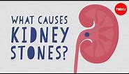 What causes kidney stones? - Arash Shadman