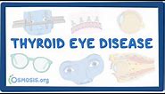 Thyroid Eye Disease- causes, symptoms, diagnosis, treatment, pathology