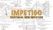 Impetigo Bacterial Skin Infection - Overview (Clinical Presentation, Pathophysiology, Treatment)