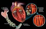 Images of Healthy Person Heart Attack