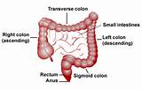 Colon Cancer Blood Work Photos