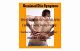 Home Remedies For Bulging Disc Pain Pictures