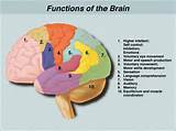 What Is Traumatic Brain Injury Pictures