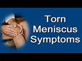 Meniscus Tear Symptoms Photos