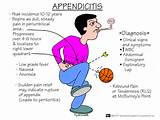 What Are The Symptoms Of Appendicitis Pictures