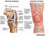 Knee Injury Assessment Pictures