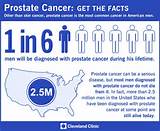 Pictures of Prostate Cancer Images