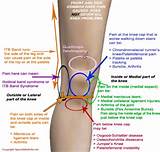 Photos of Knee Injuries Symptoms