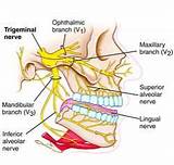 Pictures of Trigeminal Nerve