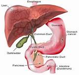 Gastric Tumor Symptoms