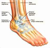 Images of Chronic Inflammation Ankle Joint