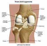 Knee Injury Video Pictures