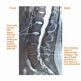 Back Problems Lumbar Images