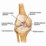 Knee Injury Ligaments Pictures