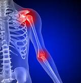 Shoulder Joint Pain Images