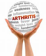 Symptom Of Arthritis