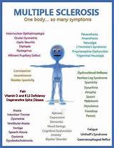 Photos of Symptoms Ms