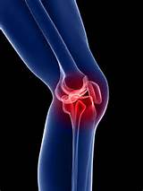 Knee Injury Without Pain Images