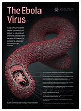 Signs And Symptoms Of Ebola Virus Infection Images