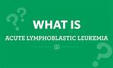 Lymphoblastic Leukemia Symptoms Pictures