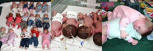 Smallest Baby Born of Multiple Births