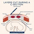 Anatomy of Cesarean Section
