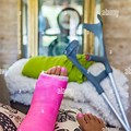 Broken Ankle Pink Cast