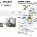 CT and Cat Scan Imaging Principle