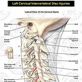 Cervical Intervertebral Disc