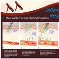 Inflammation Inflammatory Response