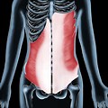 Internal Oblique Back Pain