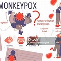 Mpox Infographic Clip Art
