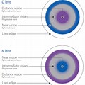 Multifocal Contact Lenses Double Vision