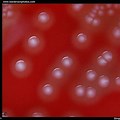 Streptococcus Pyogenes Colony Morphology