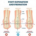 Subtalar Joint Pronation and Supination