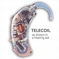 Telecoil in Hearing Aid Diagram