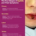 Tertiary Syphilis Symptoms