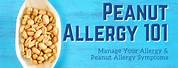 Allergy Peanut Look Like