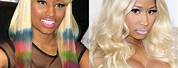Nicki Minaj Nose Job Before and After