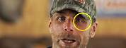Shawn Michaels Eye Injury