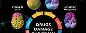 Which Brain Do You Want Drug Use Poster
