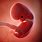 1 Week Embryo