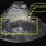 Acute Pancreatitis On Ultrasound