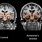 Alzheimer Brain Imaging