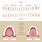 Anatomical Tooth Chart