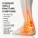 Ankle Sprain vs Fracture