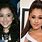Ariana Grande Cosmetic Surgery