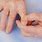Arthritis in Fingers Treatment