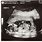 Baby Girl Ultrasound 16 Weeks